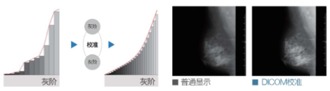 DICOM校准